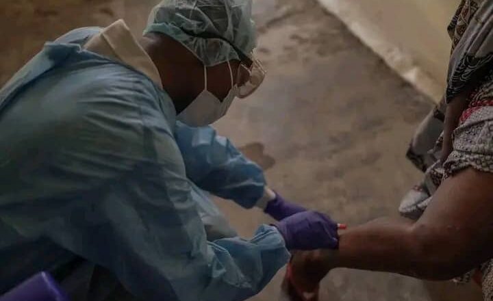 RDC: Le gouvernement alloue 49 millions de dollars pour contrer l’épidémie de Monkeypox